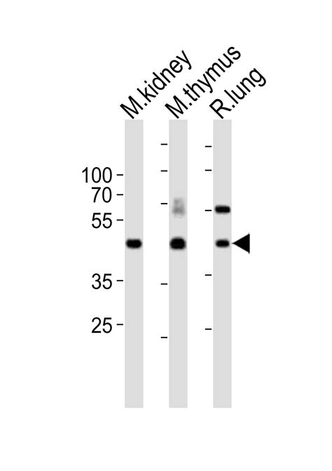 (Mouse) Dlk1 Antibody (C-term) | APR11352G | Leading Biology | Leading Biology Inc.