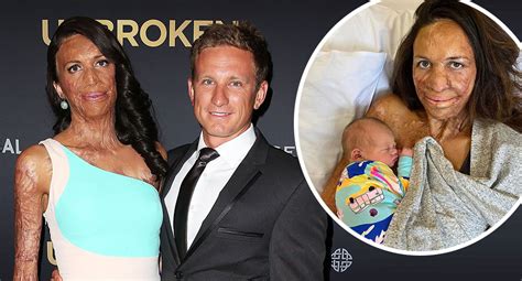 Turia Pitt Gives Birth To A Healthy Baby Boy New Idea Magazine