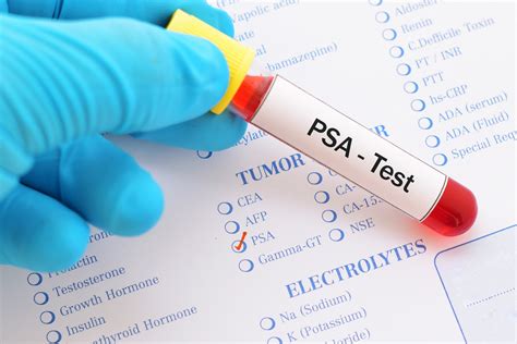 How do they measure it? Elevated PSA in Men - Prostate Cancer test - Urology Austin