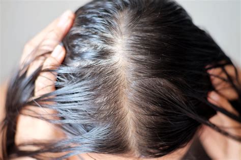 More Than 4 In 10 Women Have Suffered From Hair Loss With Sufferers