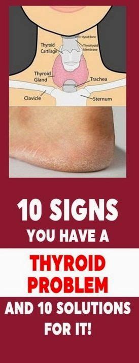 10 Signs You Have A Thyroid Problem And 10 Solutions For It Best