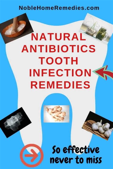 Best Natural Antibiotics Tooth Abscess Symptoms And Treatments