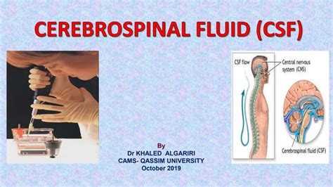 Cerebrospinal Fluid Csf And Interpreting Lumbar Puncture Ppt