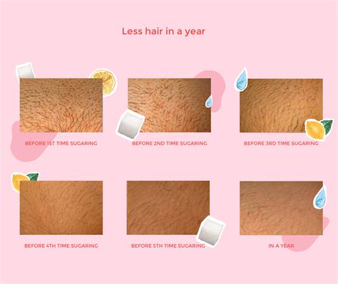 Any less and the wax won't. Brazilian Sugaring Waxing Chicago