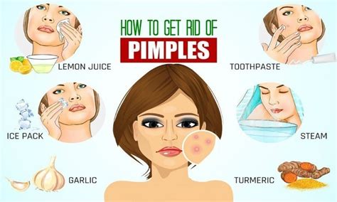 How To Get Rid Of Pimples Naturally