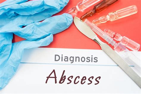 Skin Abscess Causes Symptoms And Treatment Erectile Doctor