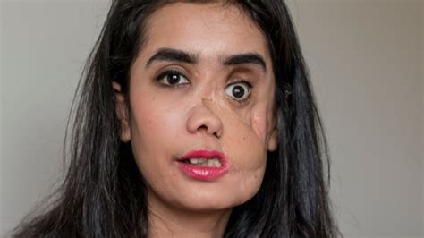 Shot In The Face By Her Husband In Afghanistan Former Teen Bride