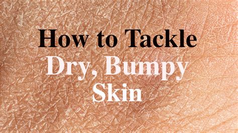 How To Tackle Dry Bumpy Skin Womenworking