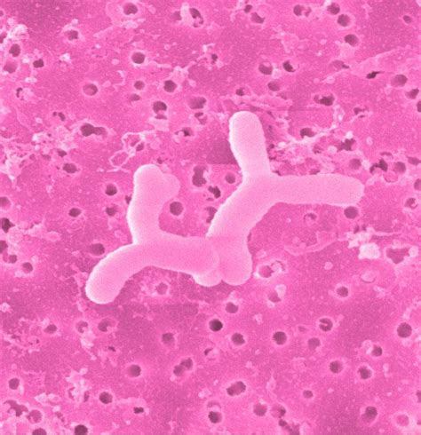 Bifidobacterium Infantis бактерия что это препараты