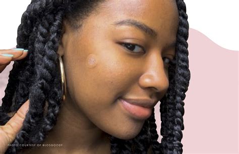 The Best Pimple Patches To Use For Each Type Of Blemish