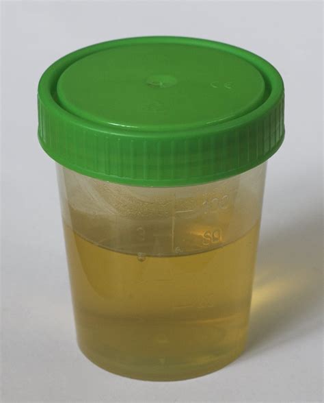 Urine Composition De Lurine Humaine