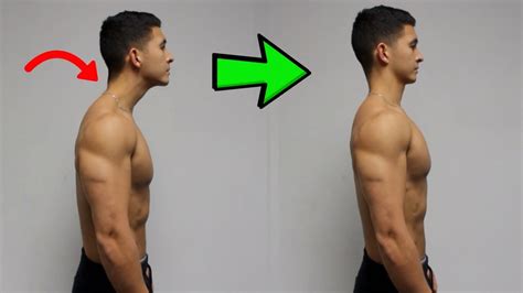 Fix Forward Head Posture Daily Corrective Routine Youtube