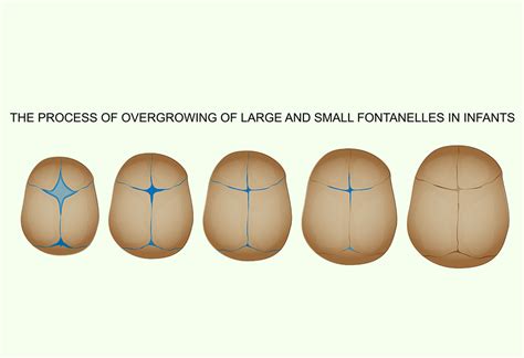 Fontanelles On Newborn Head Reasons Signs And Treatment