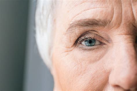 How To Treat Under Eye Wrinkles Pulse Play
