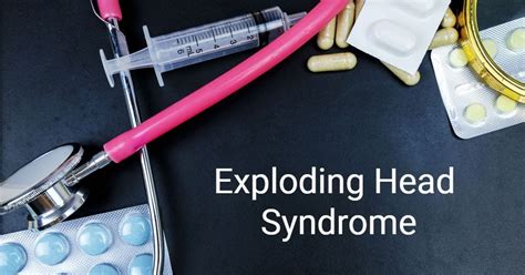 What Is Exploding Head Syndrome Facty Health