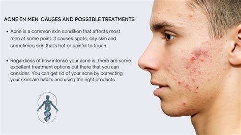 Acne In Men Causes And Possible Treatments Vanity Male