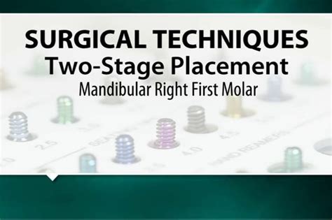 Two Stage Surgical Technique Placement In The Mandibular Right First