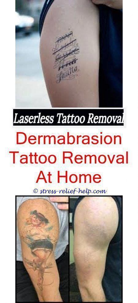 The brazilian laser hair removal method is a unique removal option especially as it is tailored down to meet the specific needs of the patient, meaning that to ensure you achieve your desired goal, always make sure you visit a specialist so you can get the most of the treatment. How soon can you get your tattoo removed.Tattoo removal ...