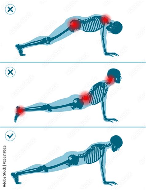 Wrong And Correct Plank Pose Right And Wrong Execution Technique Of