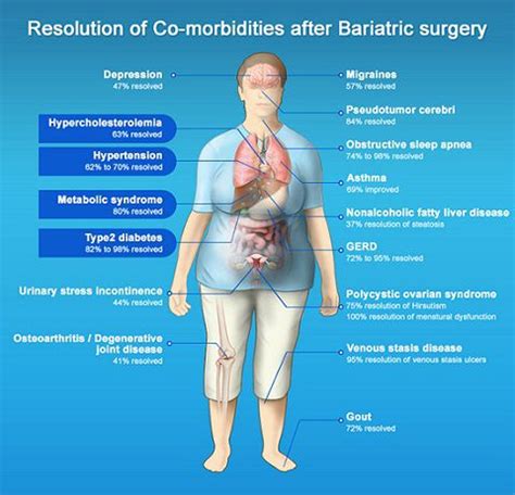 Pediatric endocrinologist anna haddal discusses prevention and management of common comorbidities that can affect obese children. Bariatric Surgery Saudi Arabia | Obesity Surgery Saudi Arabia