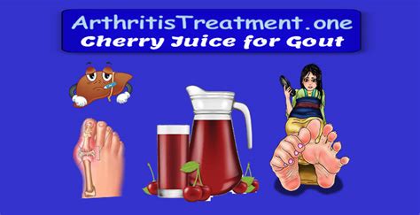 1 Tart Cherry Juice For Gout Extract Of Cherries For Gout