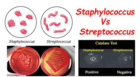 Differences Between Staphylococcus And Streptococcus Online