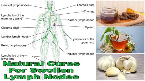Natural Cures For Swollen Lymph Nodes Youtube
