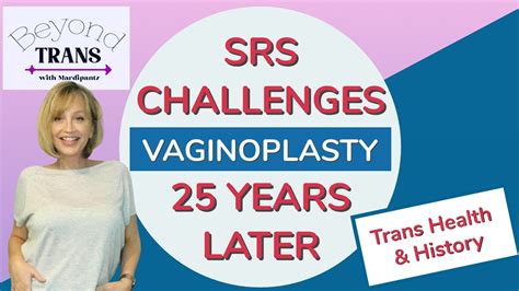 my srs vaginoplasty challenges decades later transgender mtf transition youtube