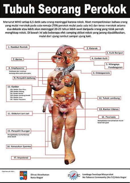 Check spelling or type a new query. TinaTinot Online 1: Perokok Dan Rawatannya.