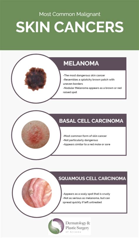 Red Spots On Skin Cancer