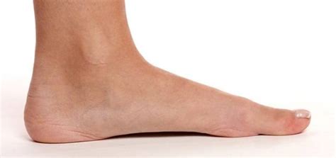 Causes Of Flat Feet Symptoms Exercises Diagnosis And Treatment