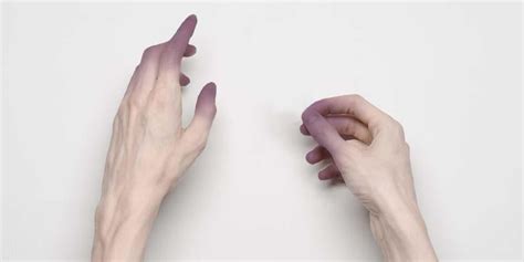 Maybe you would like to learn more about one of these? Pemicu Sianosis Adalah Kurangnya Oksigen Dalam Darah
