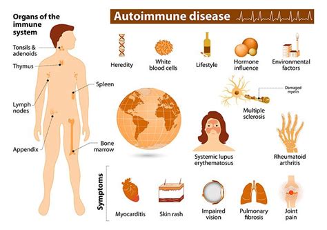 infographic with anatomy images describing symptoms autoimmune disorder autoimmune disease