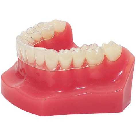 This video explains clearly, with demonstrations, how to clean a permanent retainer that is provided after braces or invisalign treatment. Lane Cove Orthodontics :: What are retainers?