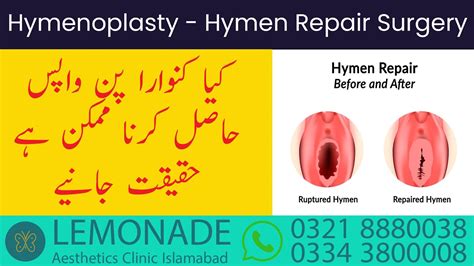 Hymenoplasty In Pakistan Virginity Repair Surgery Hymen Reconstruction Surgery Islamabad