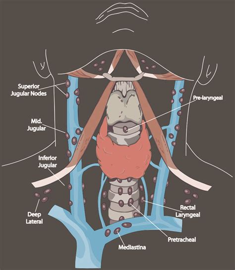 Thyroid Surgery — Thyroiddoctor And Parathyroiddoctor