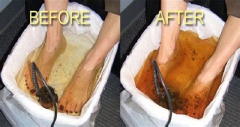 HOW TO DETOX THROUGH YOUR FEET Foot Detox Detox Recipes Body Detox