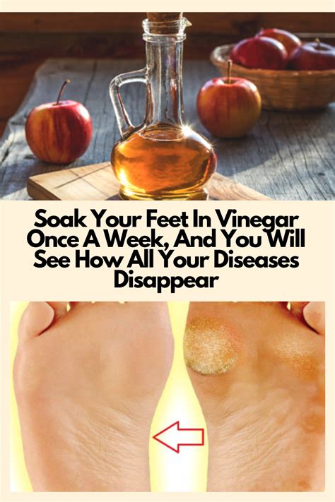 Soak Your Feet In Vinegar Once A Week And You Will See How All Your