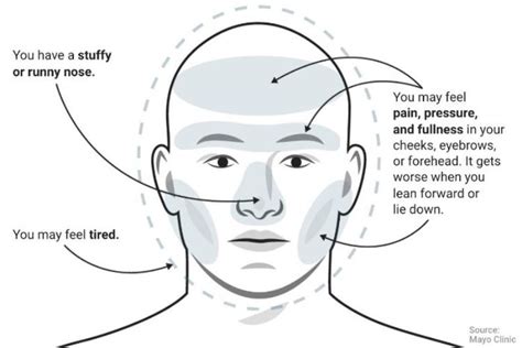 Jika sakit kepala dirasakan dalam waktu yang lama, maka sakit kepala tegang paling sering dialami oleh banyak orang. Sakit Kepala Di Dahi Dan Mata - Berbagai Mata