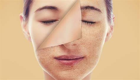 5 Signs That Show Your Skin Is Dehydrated