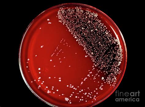 Petri Dish Culture Of Skin Bacteria Photograph By John Durhamscience