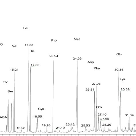The Separation Chromatogram Of Amino Acids In A Plasma Sample Ala