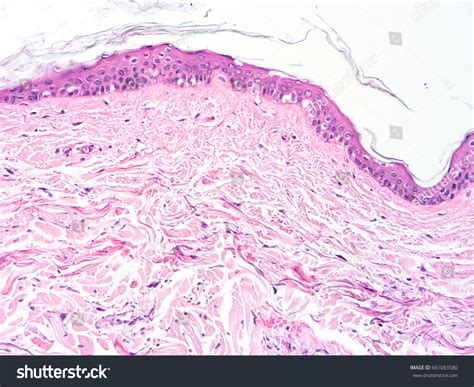 Histology Skin Human Tissue Show Epithelium 스톡 사진 661083580 Shutterstock