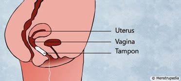 How to use and insert a tampon with diagram. Insert Tampon Diagram