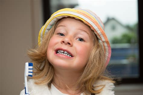 Why Its Important For Children To Get Braces Redding Ca Schalo