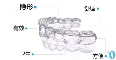 名站推薦 tips：2021年6月8日 更新失效連結 total 13 ». comfos牙套硬不硬?解密时代天使标准版跟comfos的区别及效果 牙科行业资讯 - 口腔新资讯 - 牙齿矫正网