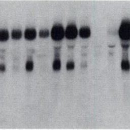 We did not find results for: (PDF) Neurofibromatosis type 2 (NF2) gene is somatically ...