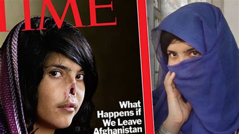 Disfigured Afghan Woman On Time Cover Also Got Finnish Help News