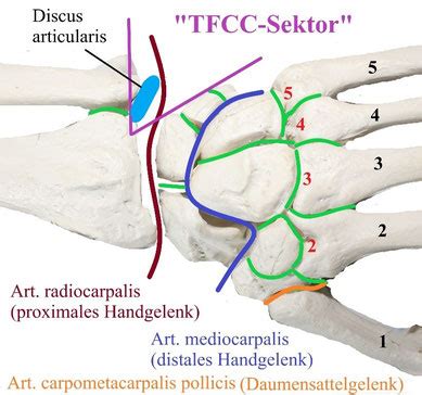 The tfcc is a blend of several different tissues that stabilize the wrist. Region 6 Handspezifische Verletzungen - see-feel-treats ...