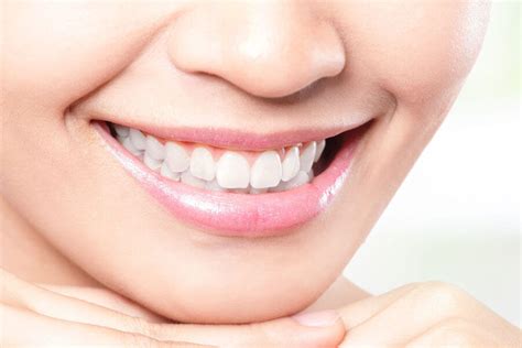 Aftercare Tips For Professional Teeth Whitening Smile Dental Center